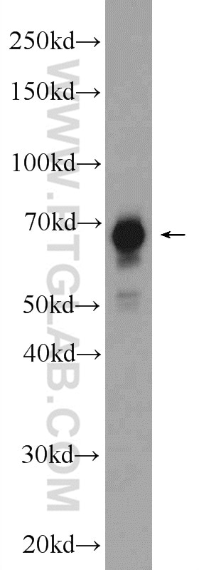 WB analysis of Jurkat using 24864-1-AP