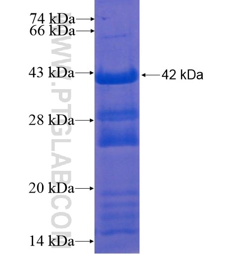 FUBP1 fusion protein Ag13149 SDS-PAGE