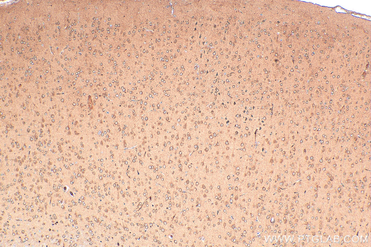 Immunohistochemistry (IHC) staining of mouse brain tissue using FUCA1 Polyclonal antibody (16420-1-AP)