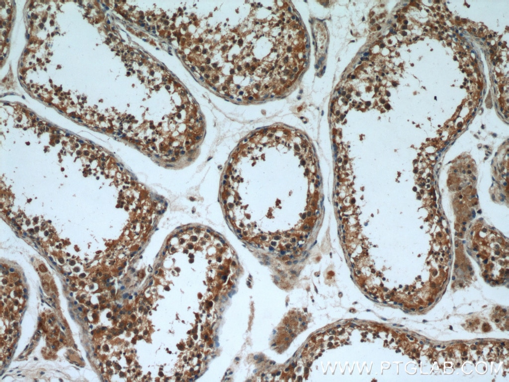 Immunohistochemistry (IHC) staining of human testis tissue using FUCA1 Polyclonal antibody (16420-1-AP)