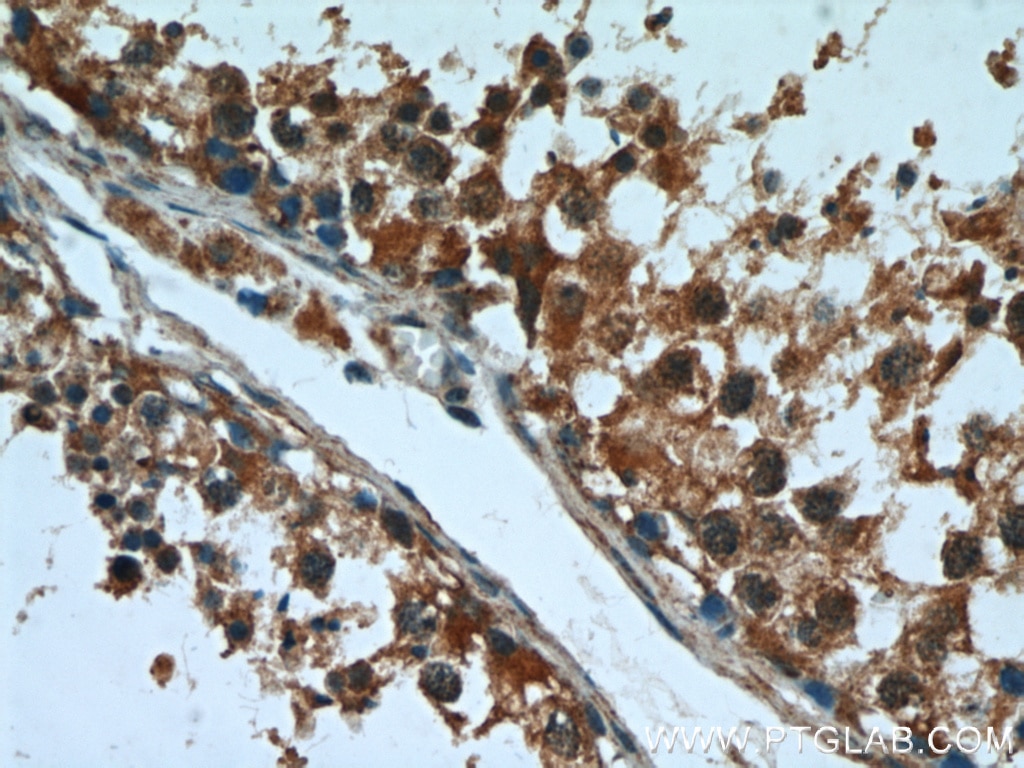 IHC staining of human testis using 16420-1-AP