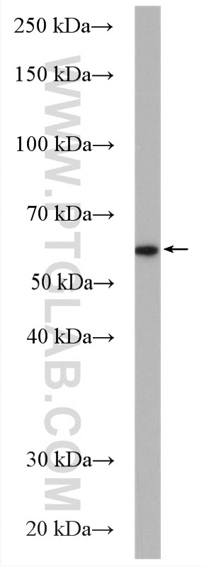 Western Blot (WB) analysis of COLO 320 cells using FUCA1 Polyclonal antibody (16420-1-AP)