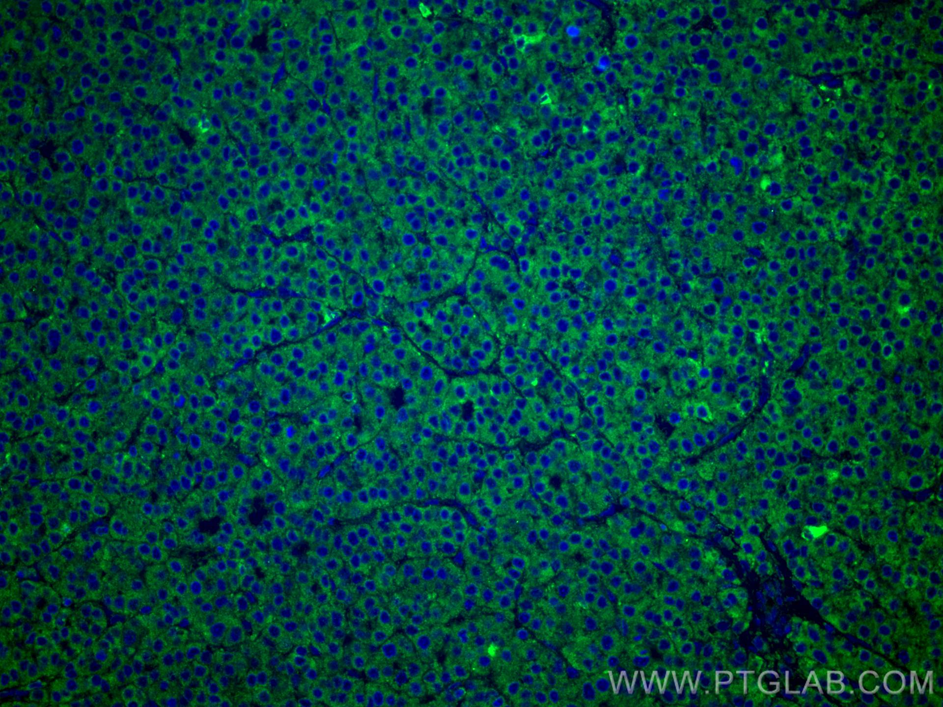 Immunofluorescence (IF) / fluorescent staining of human liver cancer tissue using FUCA1 Monoclonal antibody (67251-1-Ig)