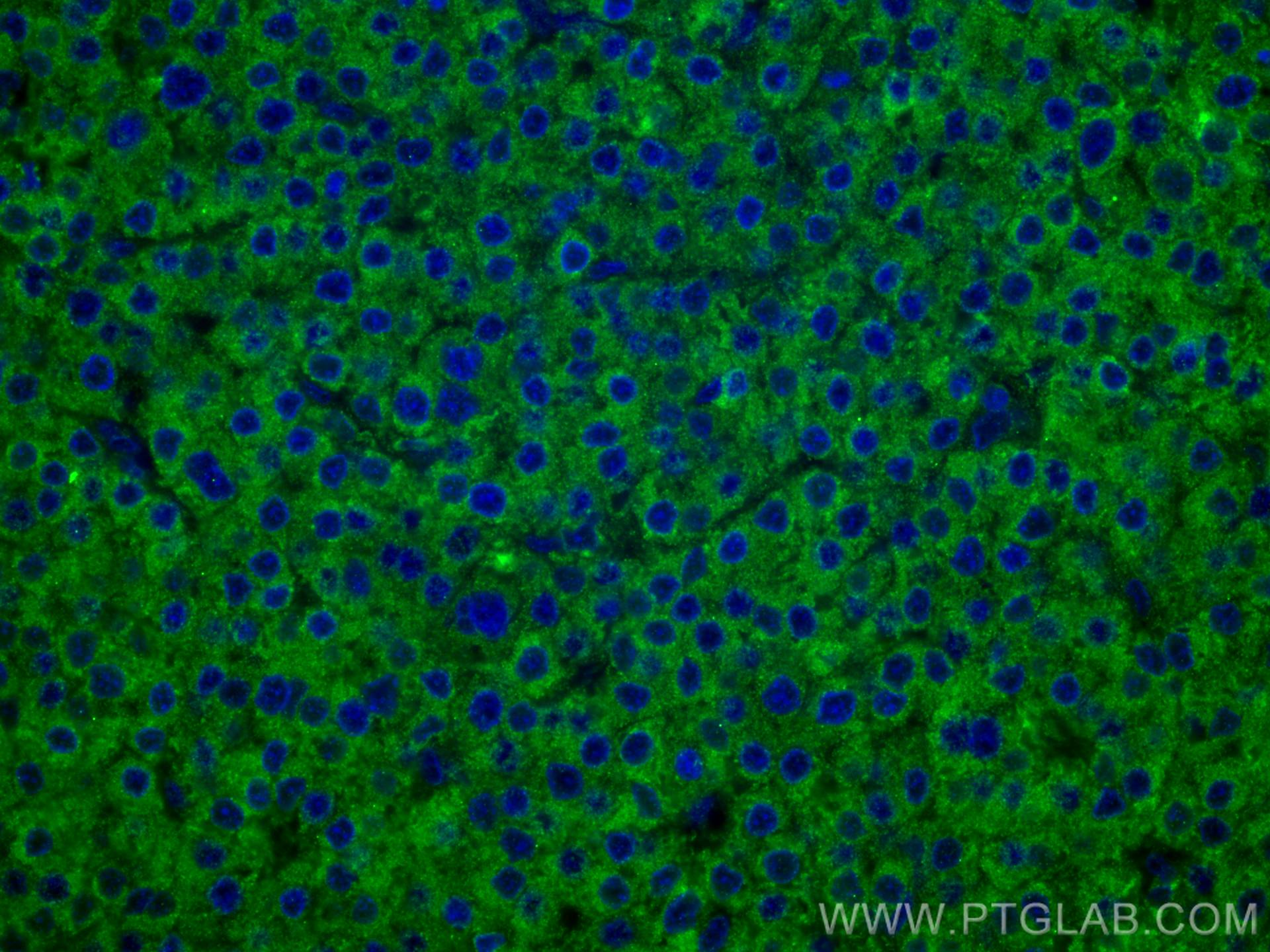 Immunofluorescence (IF) / fluorescent staining of human liver cancer tissue using FUCA1 Monoclonal antibody (67251-1-Ig)