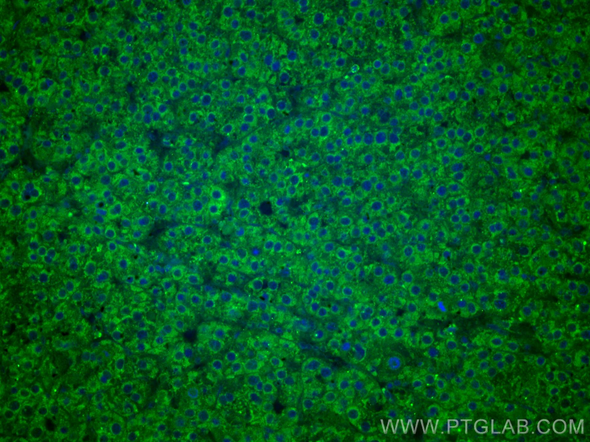 Immunofluorescence (IF) / fluorescent staining of human liver cancer tissue using CoraLite® Plus 488-conjugated FUCA1 Monoclonal ant (CL488-67251)