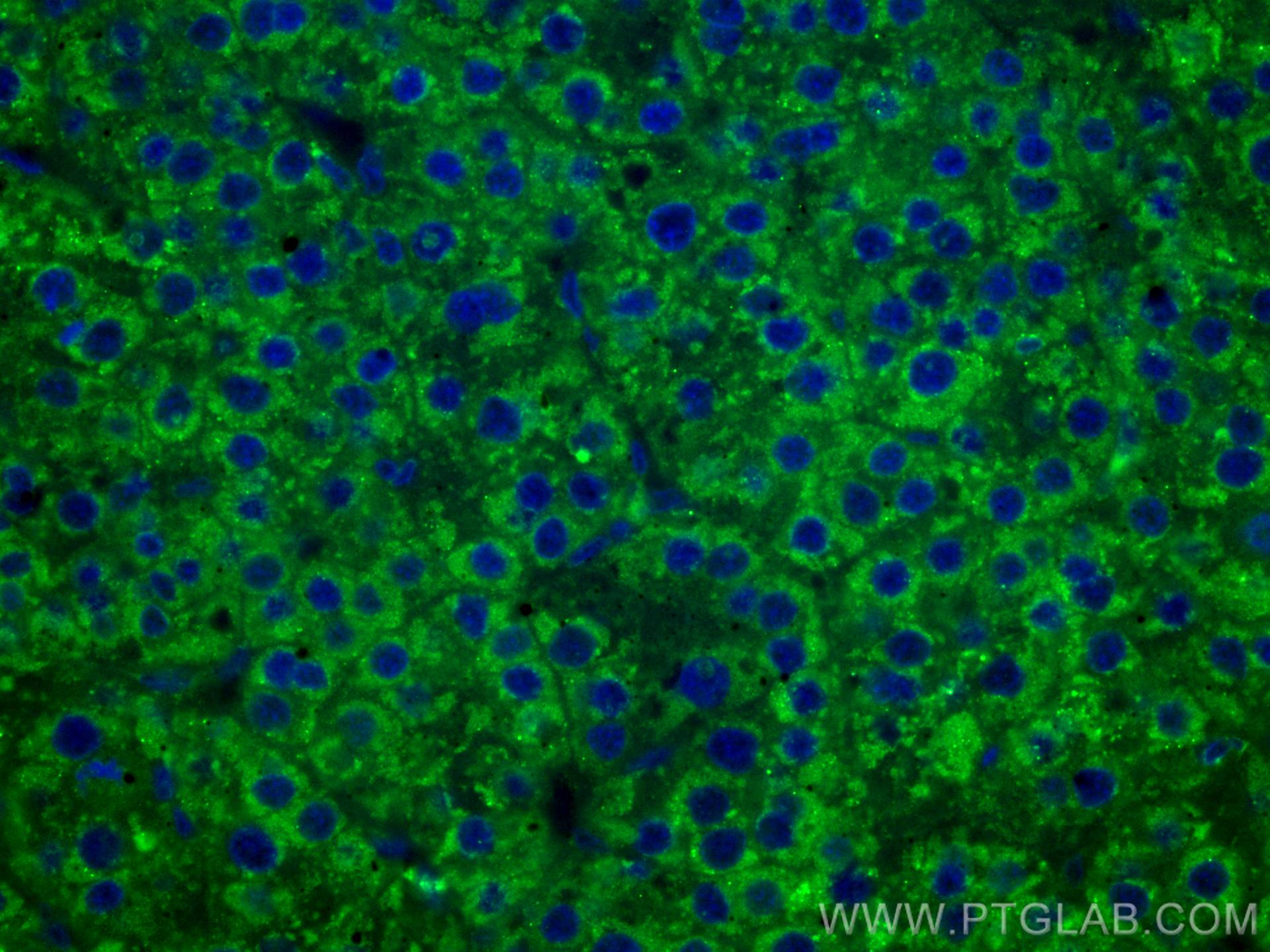 Immunofluorescence (IF) / fluorescent staining of human liver cancer tissue using CoraLite® Plus 488-conjugated FUCA1 Monoclonal ant (CL488-67251)