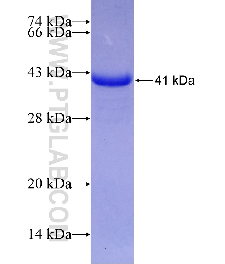 FUCA1 fusion protein Ag9638 SDS-PAGE
