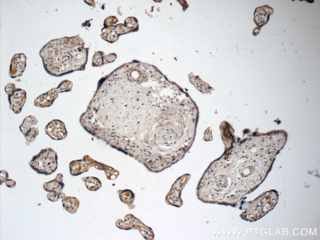 IHC staining of human placenta using 15157-1-AP