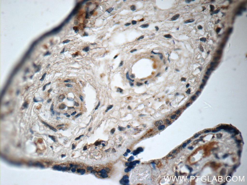 IHC staining of human placenta using 15157-1-AP