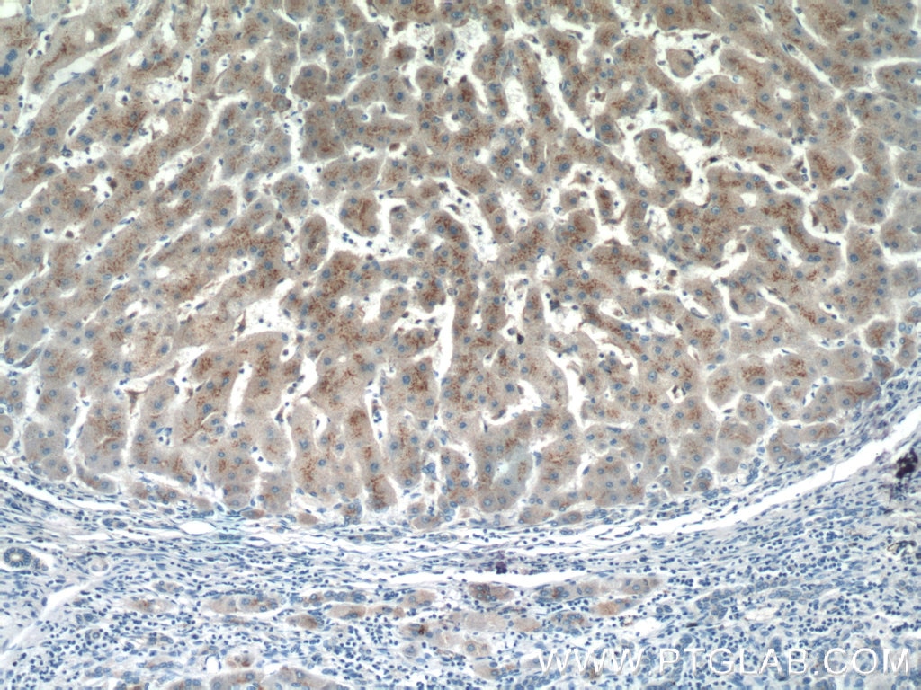 Immunohistochemistry (IHC) staining of human hepatocirrhosis tissue using FUCA2 Polyclonal antibody (15157-1-AP)