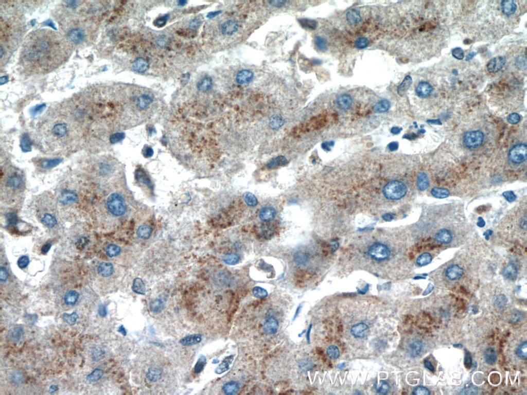 Immunohistochemistry (IHC) staining of human hepatocirrhosis tissue using FUCA2 Polyclonal antibody (15157-1-AP)