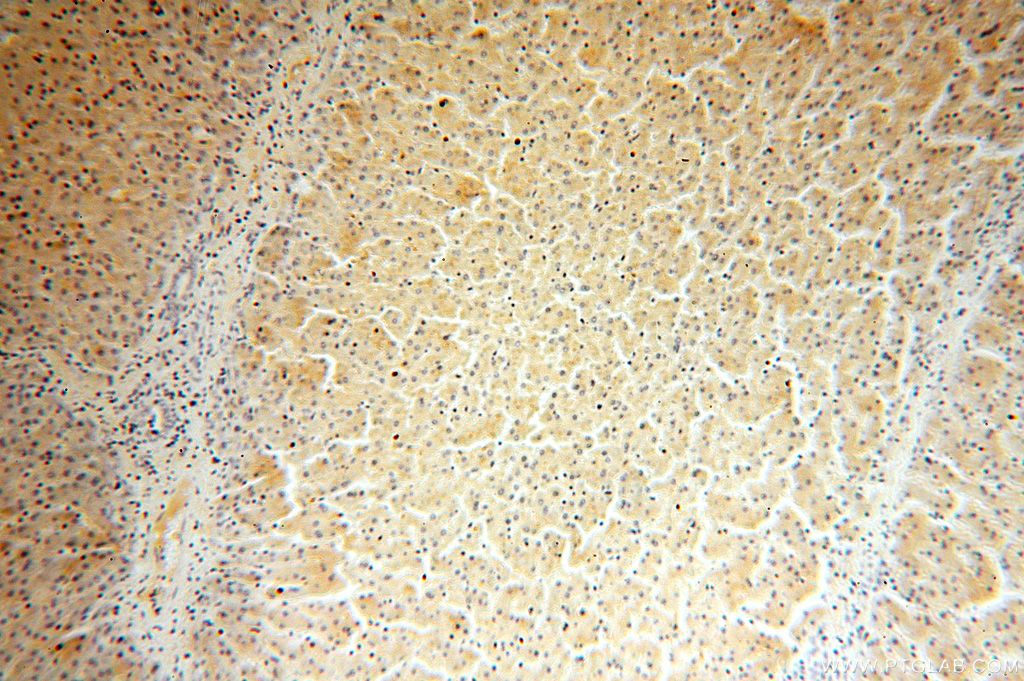 Immunohistochemistry (IHC) staining of human liver tissue using FUCA2 Polyclonal antibody (15157-1-AP)