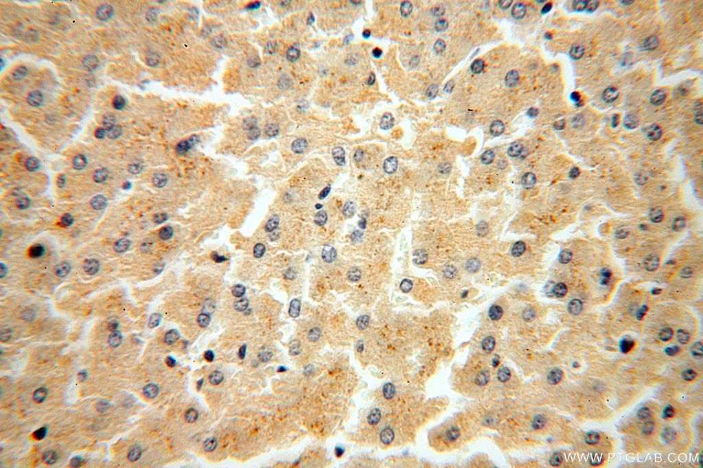IHC staining of human liver using 15157-1-AP