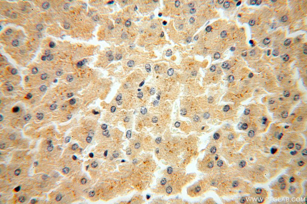 Immunohistochemistry (IHC) staining of human liver tissue using FUCA2 Polyclonal antibody (15157-1-AP)