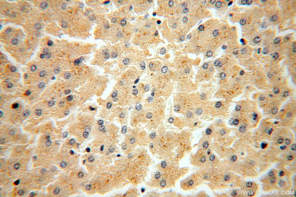 Immunohistochemistry (IHC) staining of human liver tissue using FUCA2 Polyclonal antibody (15157-1-AP)