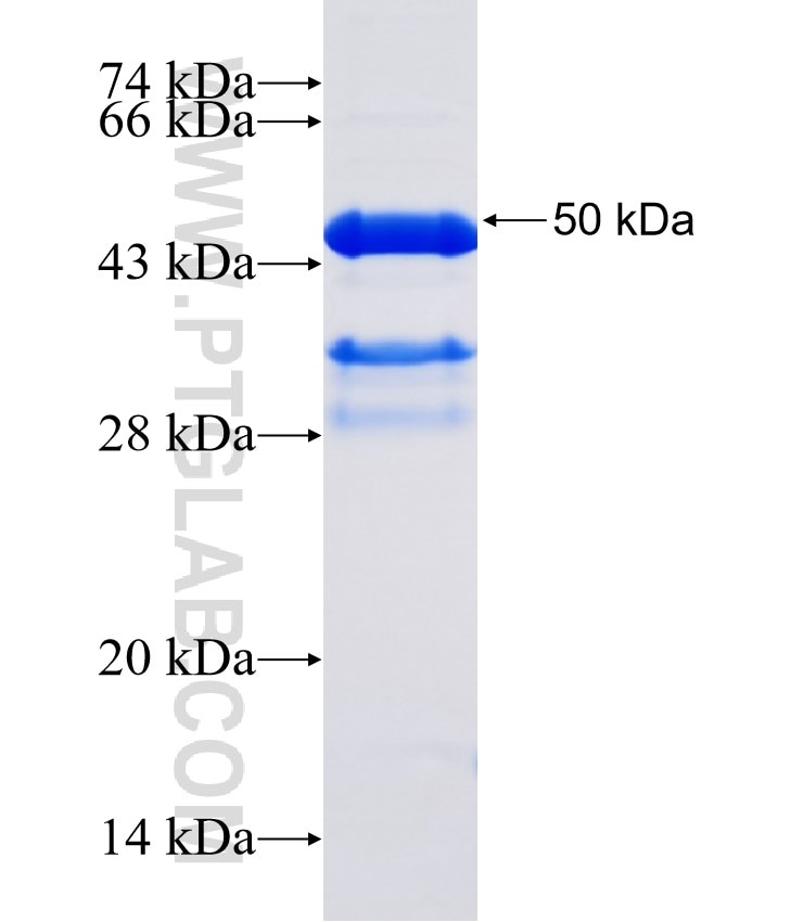 FUCA2 fusion protein Ag32467 SDS-PAGE
