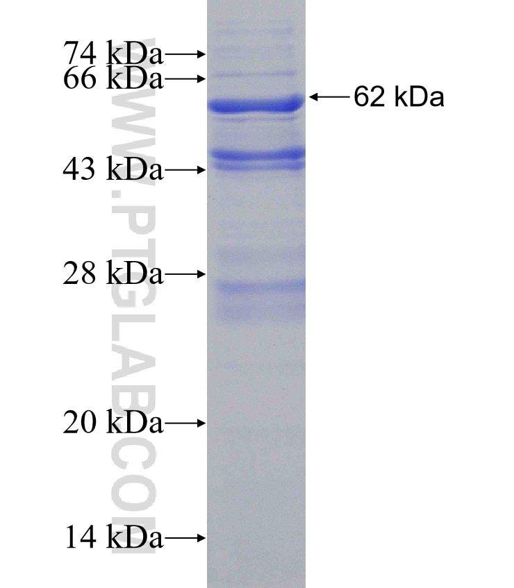 FUCA2 fusion protein Ag7250 SDS-PAGE