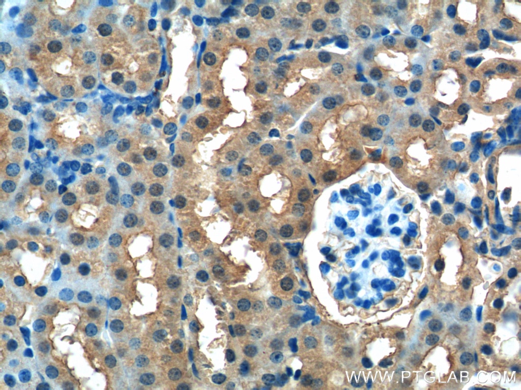 Immunohistochemistry (IHC) staining of mouse kidney tissue using FUK Polyclonal antibody (13541-1-AP)