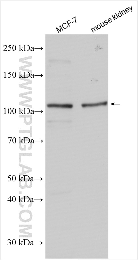 Western Blot (WB) analysis of various lysates using FUK Polyclonal antibody (13541-1-AP)