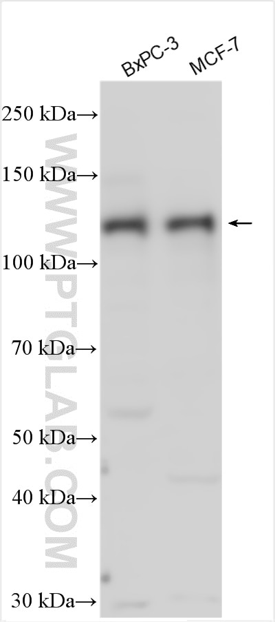 Western Blot (WB) analysis of various lysates using FUK Polyclonal antibody (13541-1-AP)
