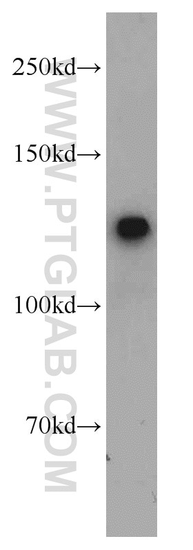 Western Blot (WB) analysis of mouse thymus tissue using FUK Polyclonal antibody (13541-1-AP)