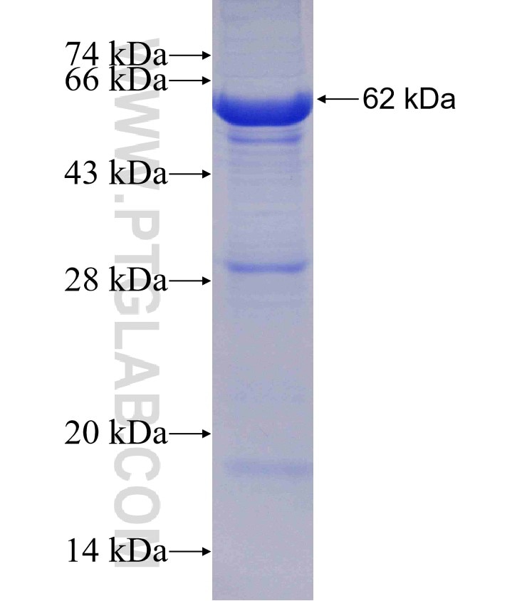 FUK fusion protein Ag4481 SDS-PAGE