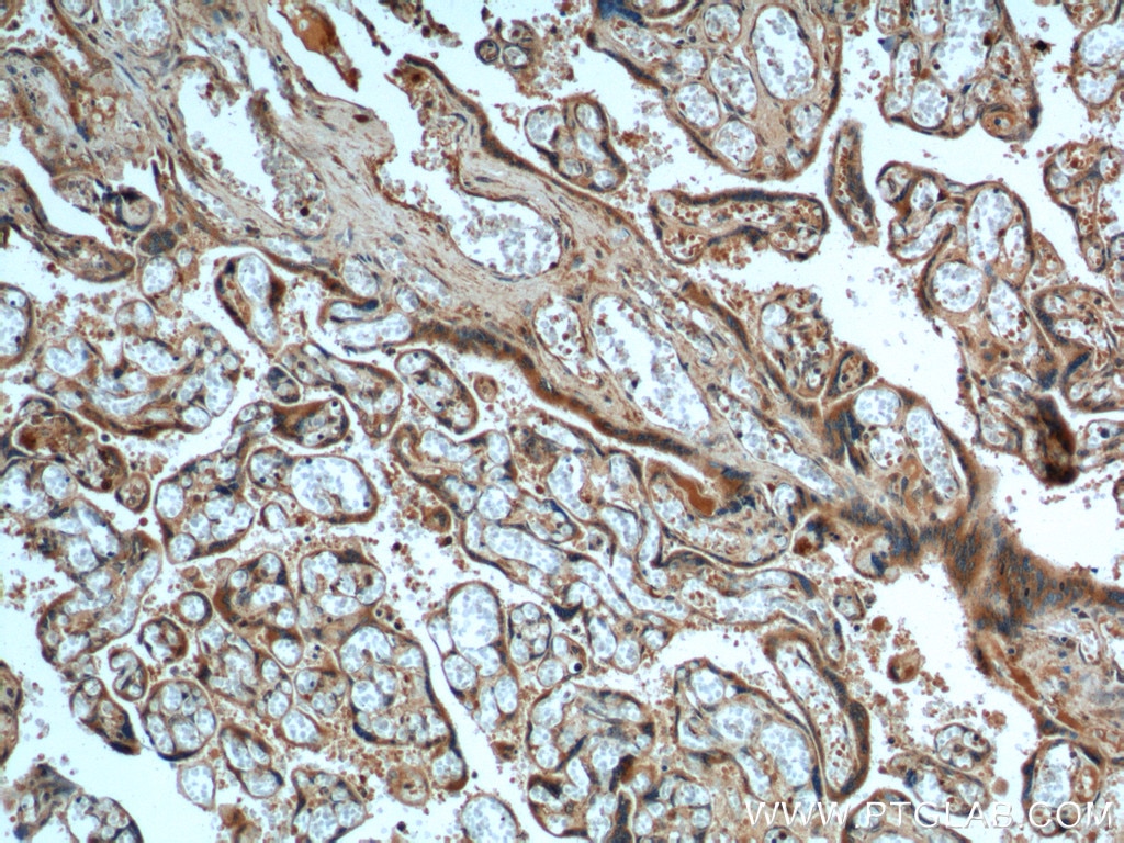 Immunohistochemistry (IHC) staining of human placenta tissue using FURIN Polyclonal antibody (18413-1-AP)