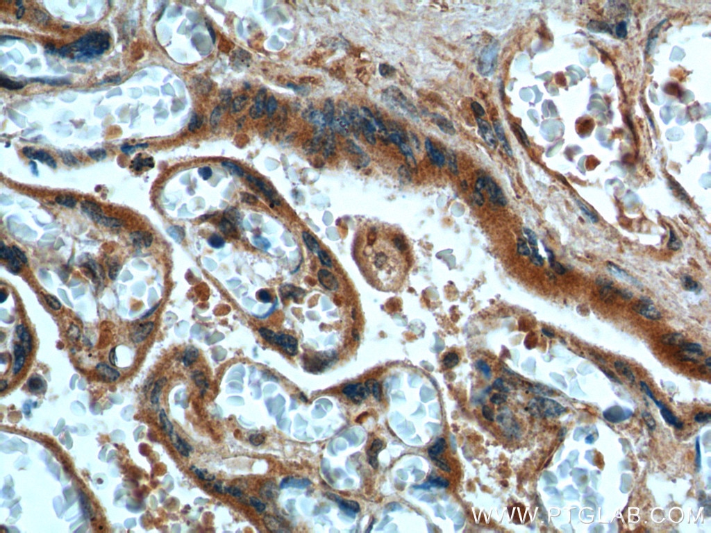 Immunohistochemistry (IHC) staining of human placenta tissue using FURIN Polyclonal antibody (18413-1-AP)