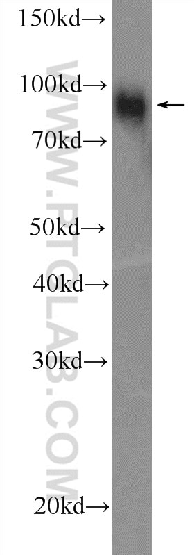 Western Blot (WB) analysis of COLO 320 cells using FURIN Polyclonal antibody (18413-1-AP)