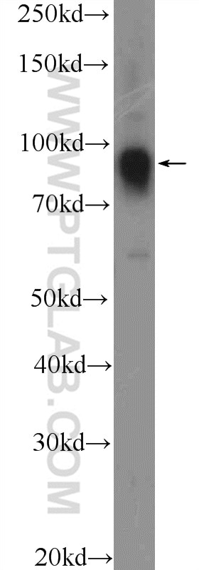 Western Blot (WB) analysis of HeLa cells using FURIN Polyclonal antibody (18413-1-AP)