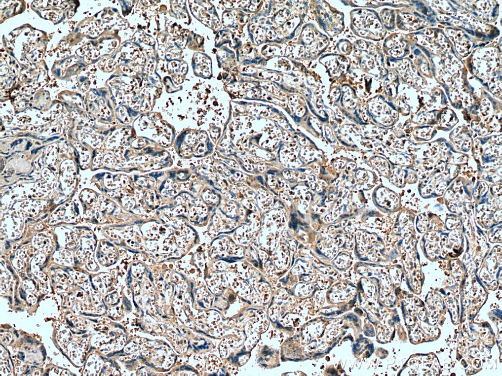 Immunohistochemistry (IHC) staining of human placenta tissue using FURIN Monoclonal antibody (67481-1-Ig)