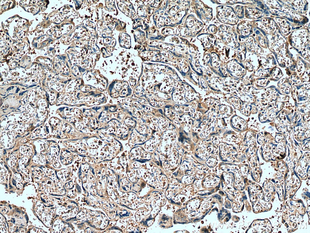 IHC staining of human placenta using 67481-1-Ig