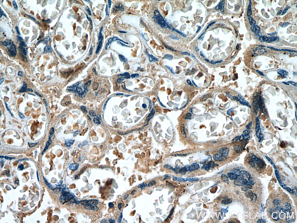Immunohistochemistry (IHC) staining of human placenta tissue using FURIN Monoclonal antibody (67481-1-Ig)