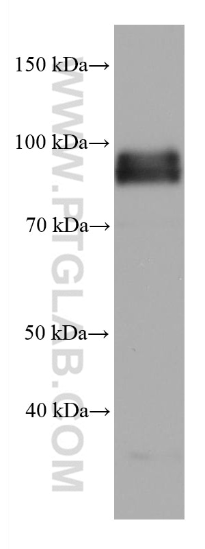 Western Blot (WB) analysis of COLO 320 cells using FURIN Monoclonal antibody (67481-1-Ig)
