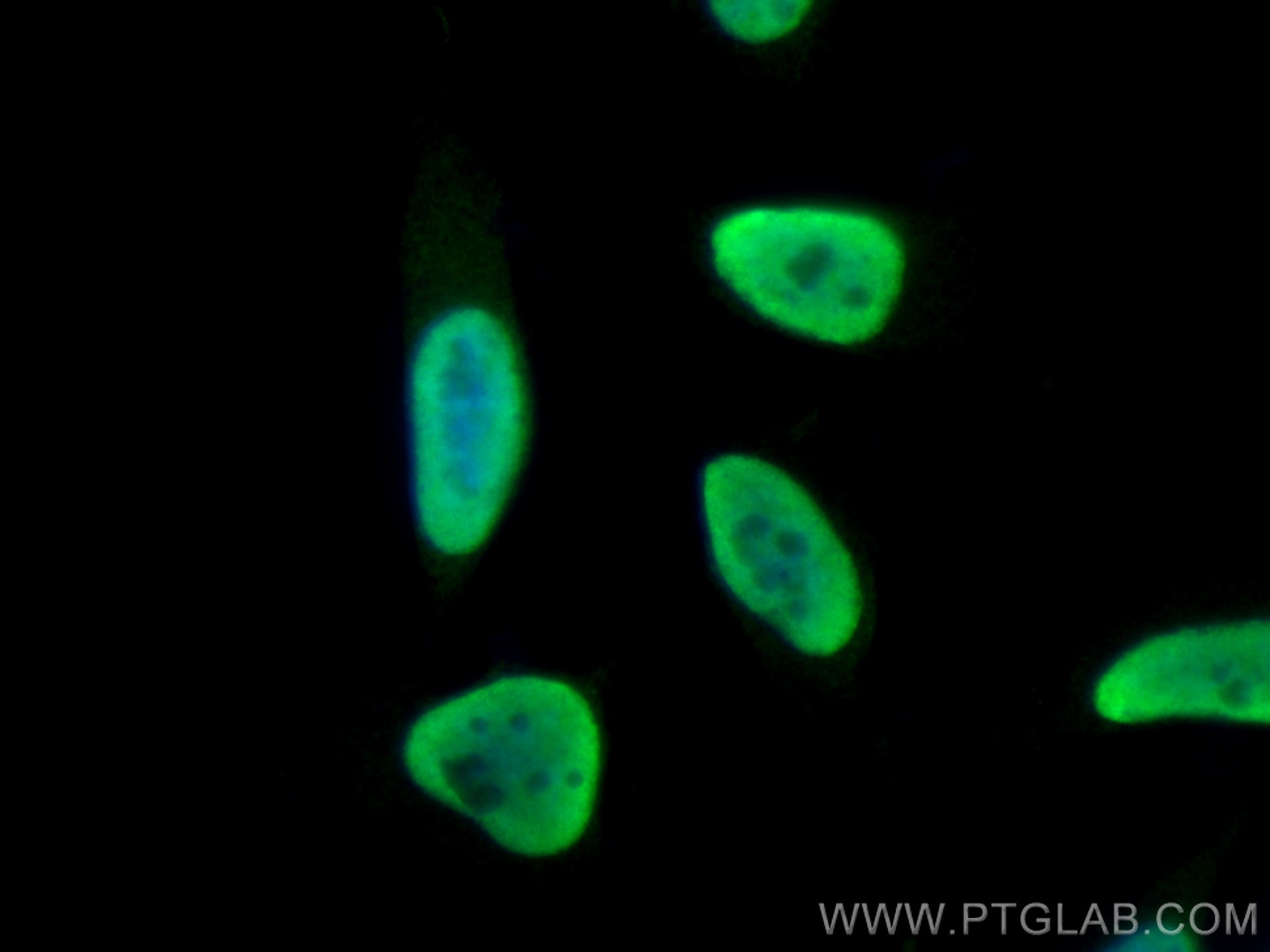 Immunofluorescence (IF) / fluorescent staining of HeLa cells using FUS/TLS Polyclonal antibody (11570-1-AP)