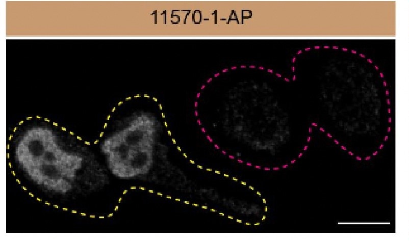 Immunofluorescence (IF) / fluorescent staining of HeLa cells using FUS/TLS Polyclonal antibody (11570-1-AP)