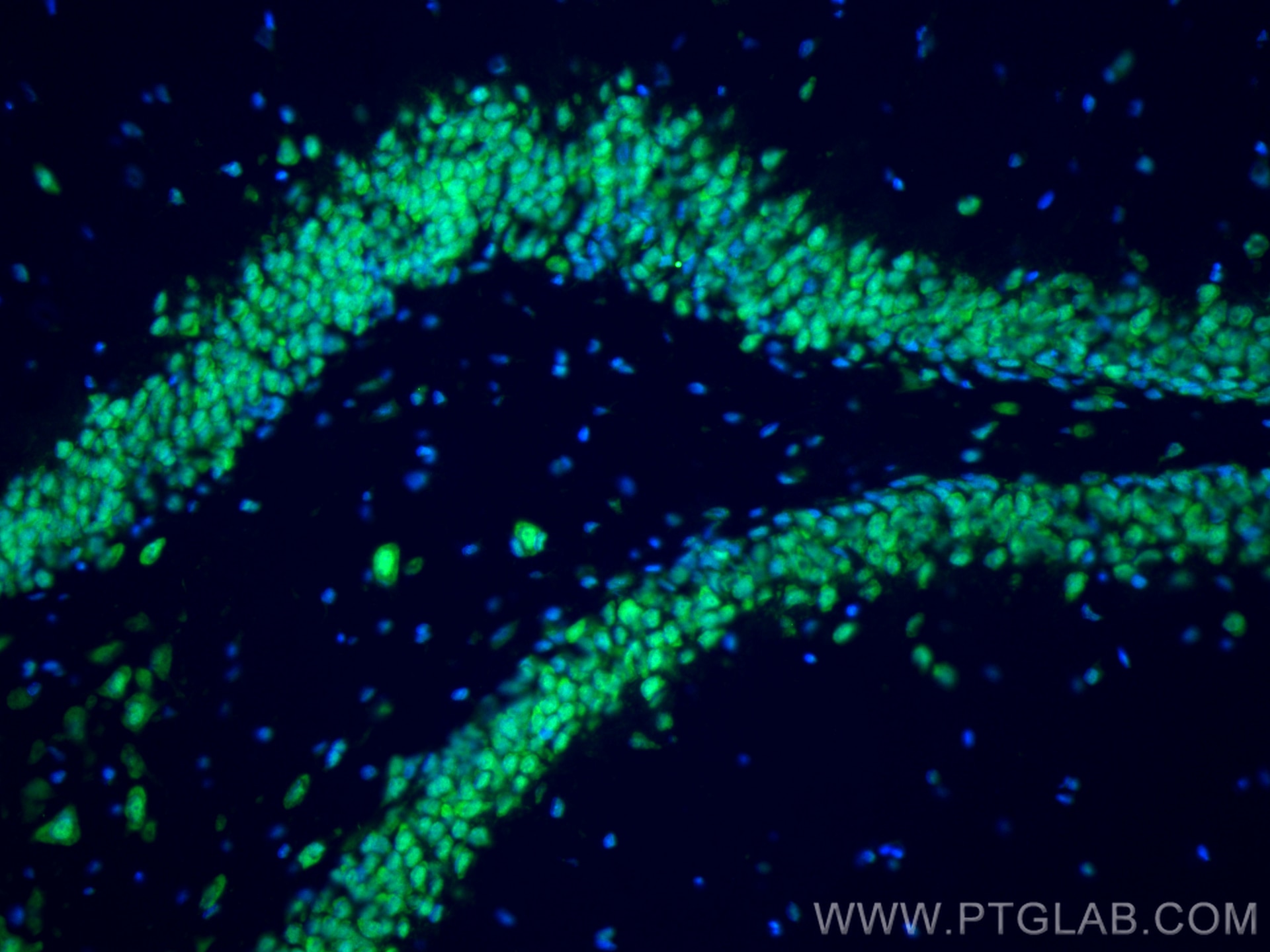 Immunofluorescence (IF) / fluorescent staining of rat brain tissue using FUS/TLS Polyclonal antibody (11570-1-AP)