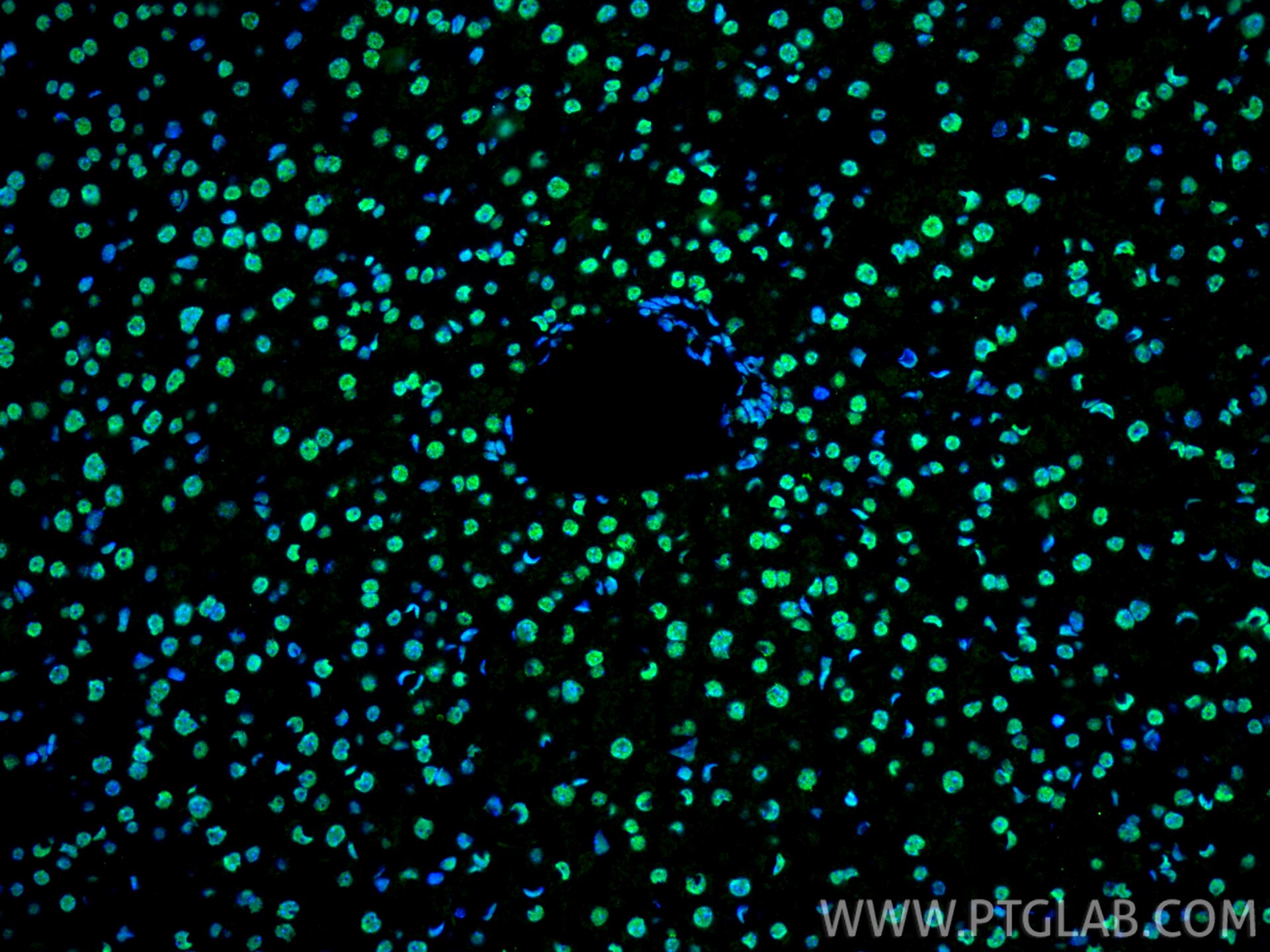 Immunofluorescence (IF) / fluorescent staining of mouse liver tissue using FUS/TLS Polyclonal antibody (11570-1-AP)