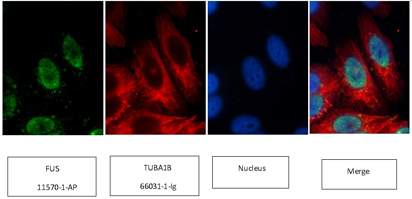 Immunofluorescence (IF) / fluorescent staining of HepG2 cells using FUS/TLS Polyclonal antibody (11570-1-AP)
