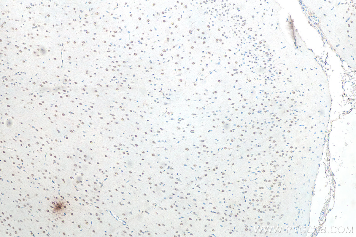 Immunohistochemistry (IHC) staining of rat brain tissue using FUS/TLS Polyclonal antibody (11570-1-AP)