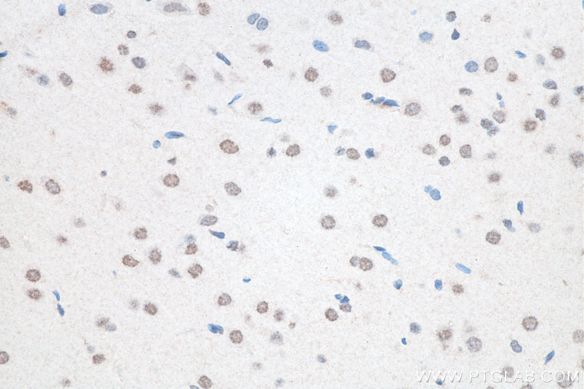 Immunohistochemistry (IHC) staining of rat brain tissue using FUS/TLS Polyclonal antibody (11570-1-AP)