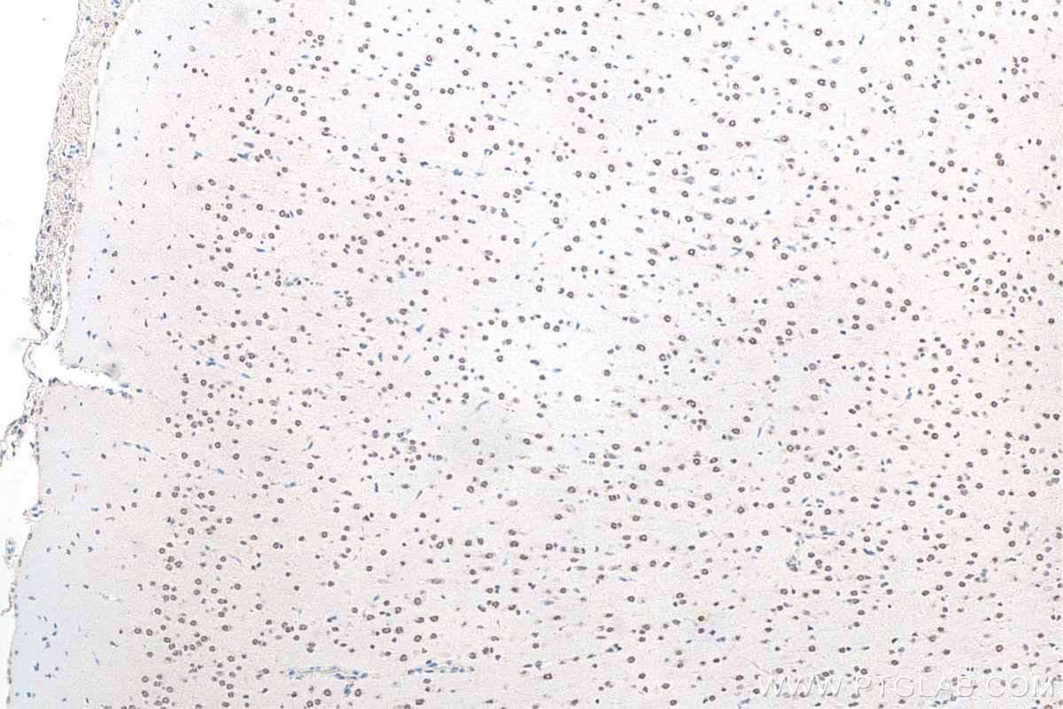 IHC staining of rat brain using 11570-1-AP Immunohistochemistry (IHC) staining of rat brain tissue using FUS/TLS Polyclonal antibody (11570-1-AP)