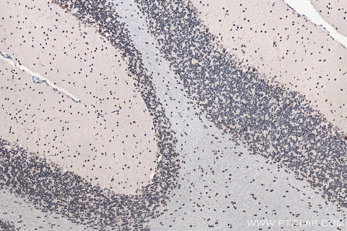 IHC staining of rat cerebellum using 11570-1-AP Immunohistochemistry (IHC) staining of rat cerebellum tissue using FUS/TLS Polyclonal antibody (11570-1-AP)