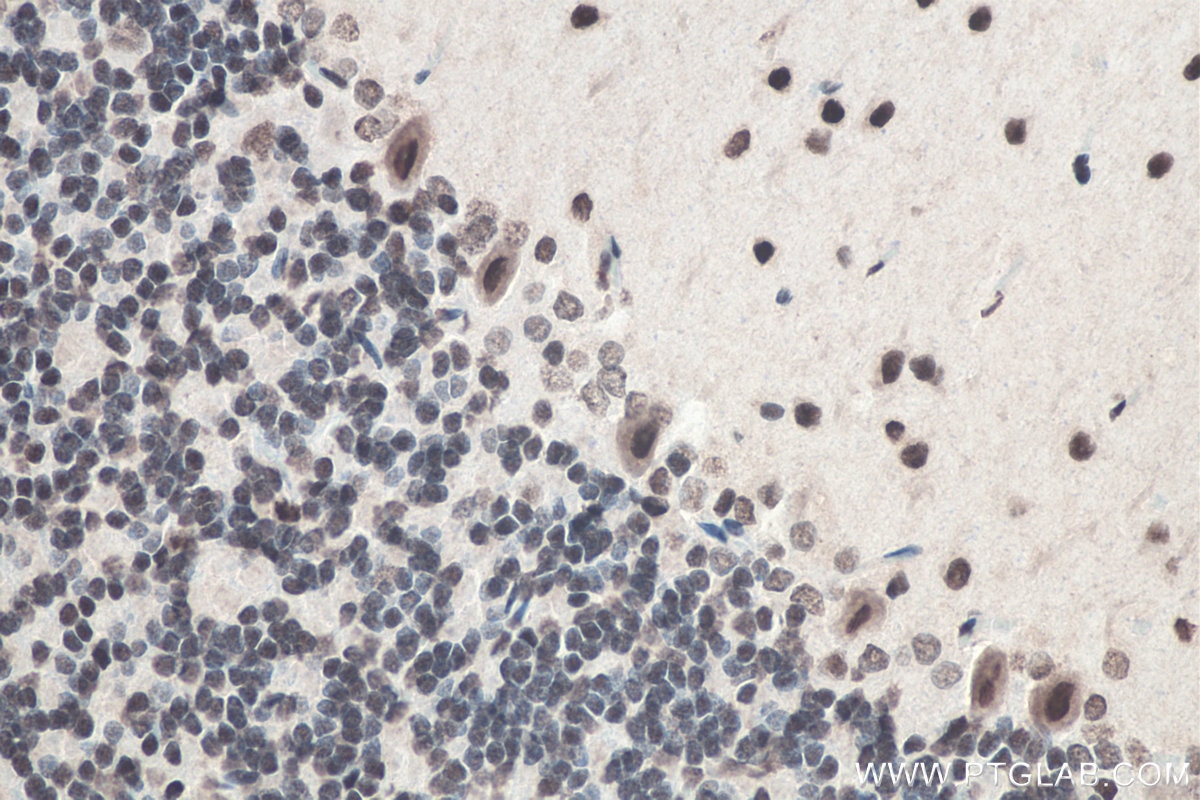 IHC staining of rat cerebellum using 11570-1-AP