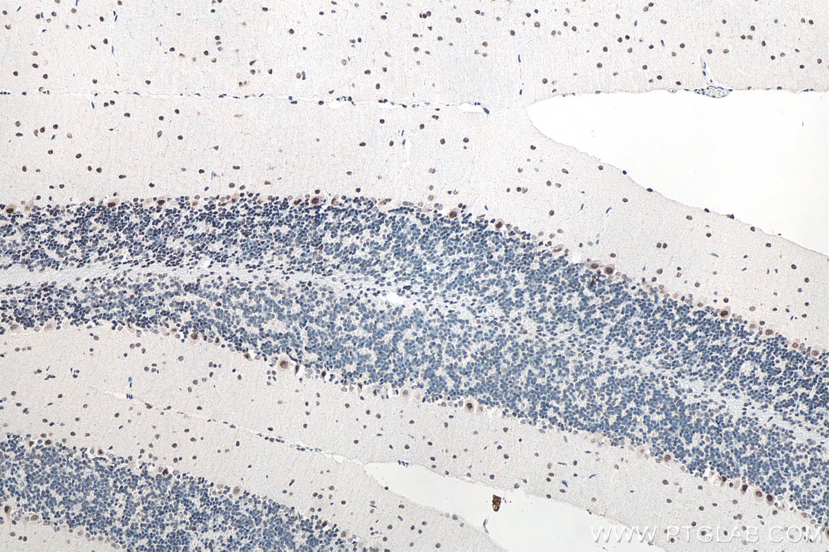 IHC staining of mouse cerebellum using 11570-1-AP Immunohistochemistry (IHC) staining of mouse cerebellum tissue using FUS/TLS Polyclonal antibody (11570-1-AP)