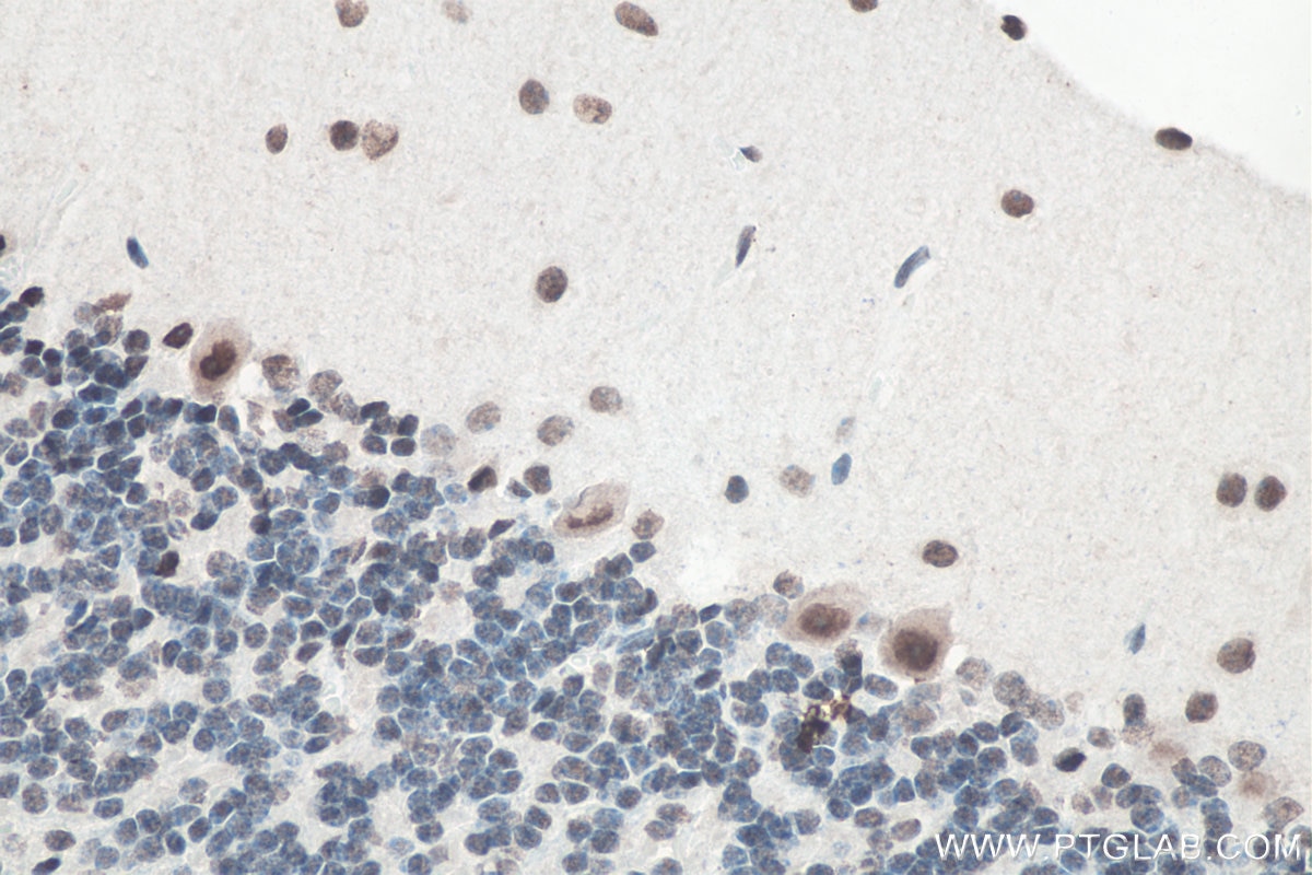 IHC staining of mouse cerebellum using 11570-1-AP