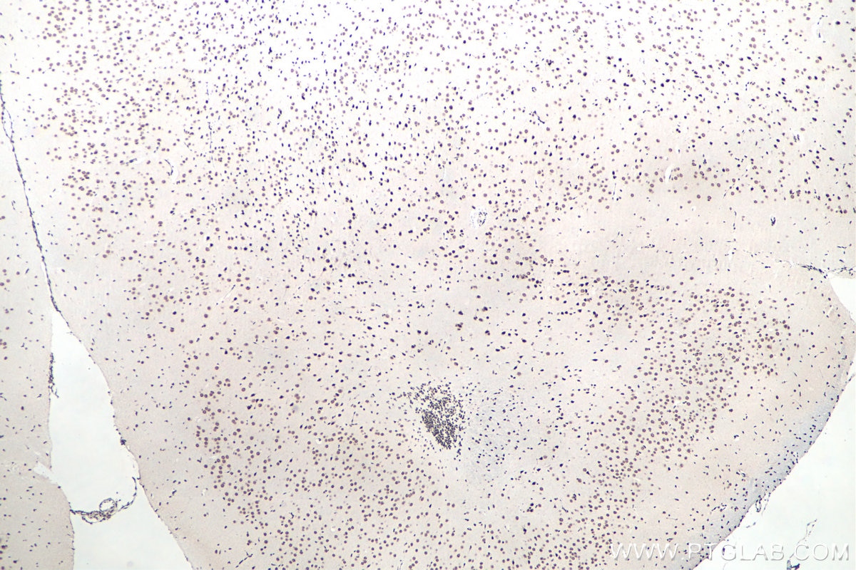 IHC staining of mouse brain using 11570-1-AP Immunohistochemistry (IHC) staining of mouse brain tissue using FUS/TLS Polyclonal antibody (11570-1-AP)