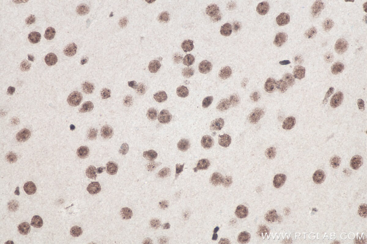 IHC staining of mouse brain using 11570-1-AP