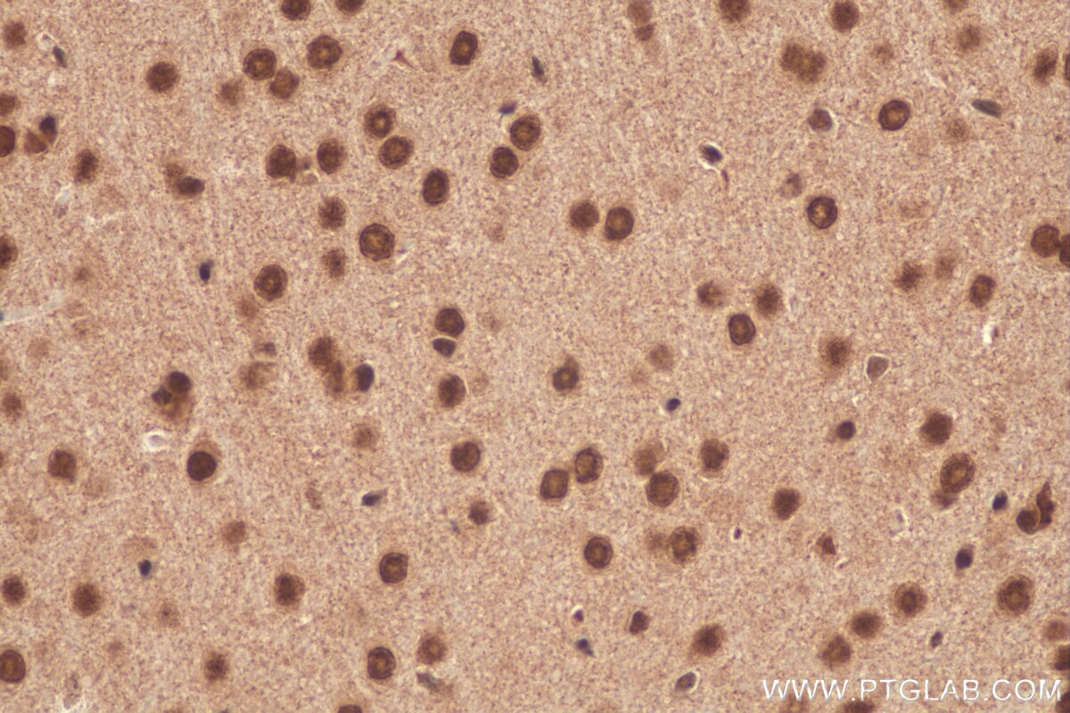 Immunohistochemistry (IHC) staining of mouse brain tissue using FUS/TLS Polyclonal antibody (11570-1-AP)