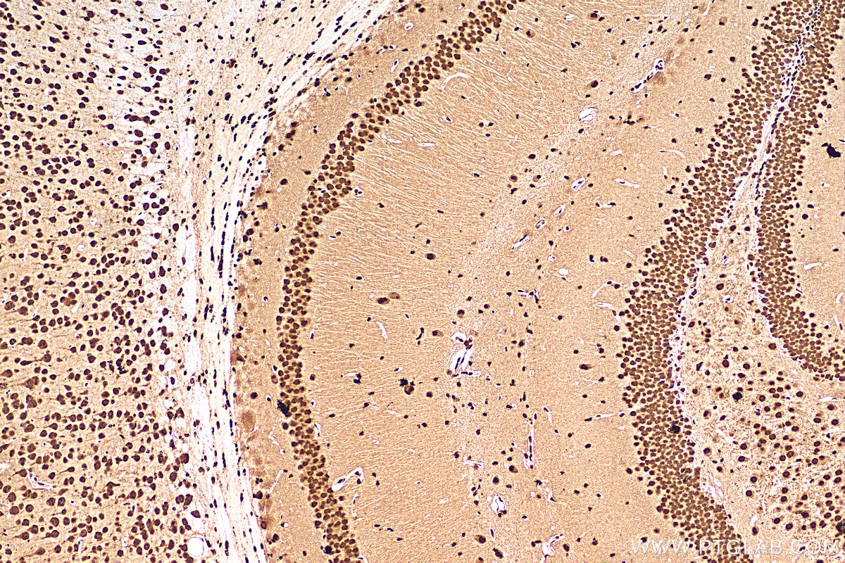 Immunohistochemistry (IHC) staining of mouse brain tissue using FUS/TLS Polyclonal antibody (11570-1-AP)